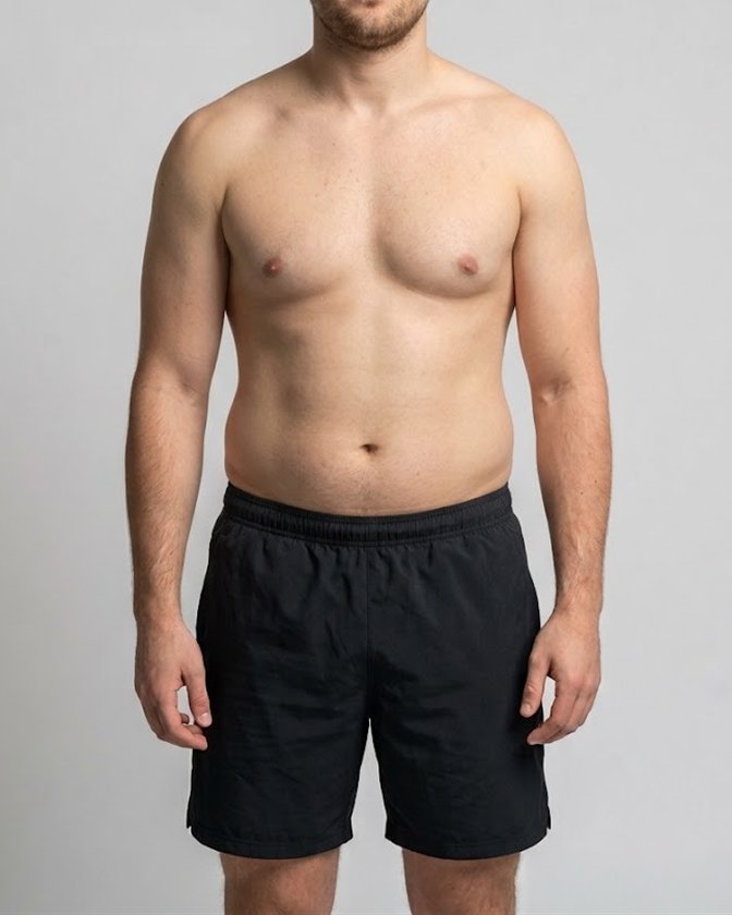 A man at about 25% body fat