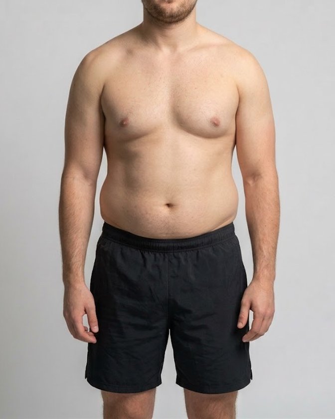 A man at about 30% body fat