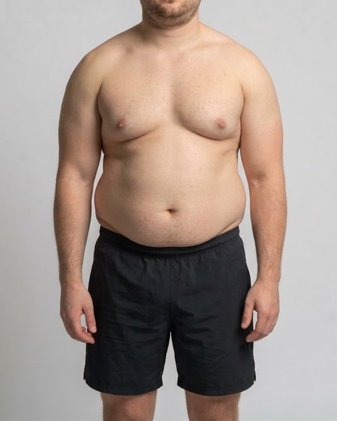 A man at about 35% body fat